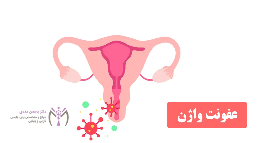 انواع عفونت واژن با تصویر